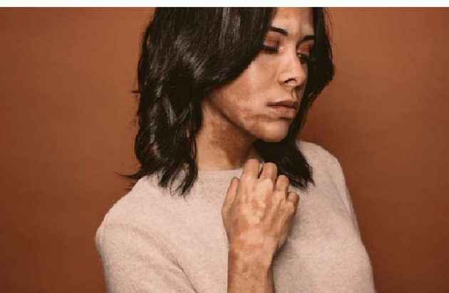 Image not available